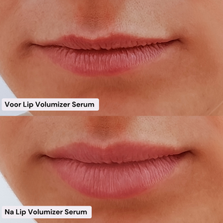 Lip Volumizer Serum - Lip Plumper